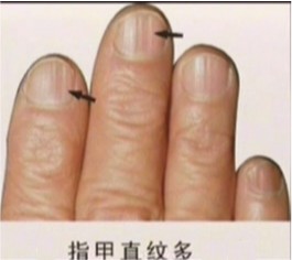 手指告诉你寿命有多长?151 / 作者:谁家小猪 / 帖子ID:111442 手指告诉你寿命有多长?151 / 作者:谁家小猪 / 帖子ID:111442